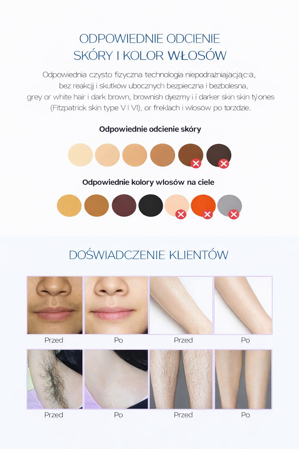 Depilator Laserowy IPL 3w1 z Chłodzeniem ICE – Trwałe Usuwanie Włosów w Domu